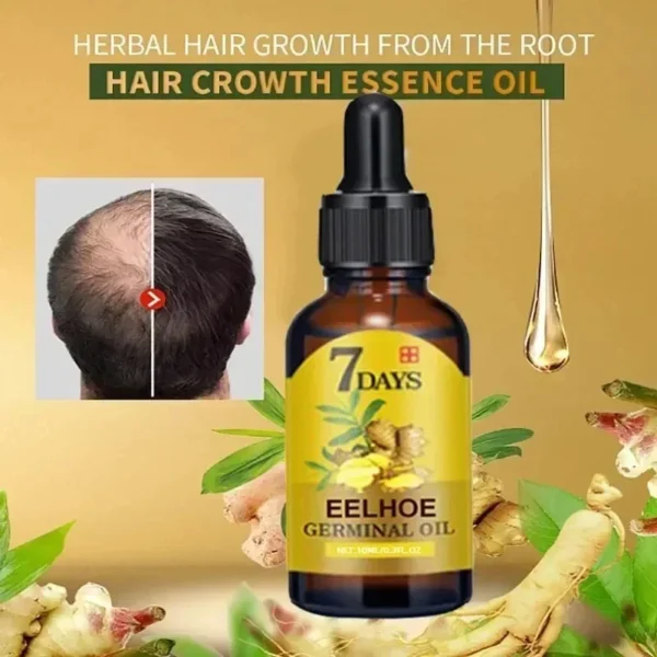 7 Day Rapid Growth Liquid Anti Hair Loss Ginger Growth Conditioning  Treatment Nourish Hair Growth Oil Scalp Care Serum Products - Image 4