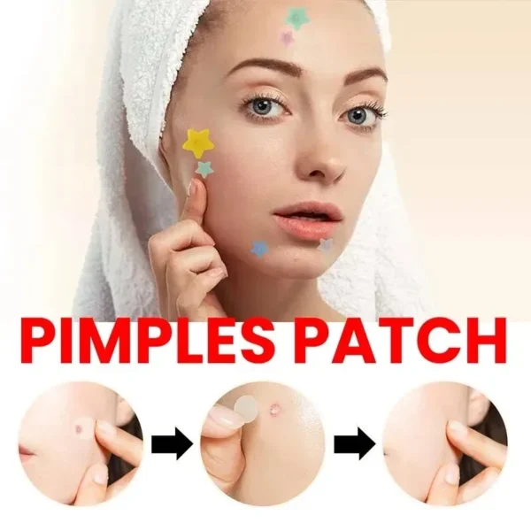 200pcs Repair Acne Patch Facial Skin Care Fade Blemishes Pimple Marks Closed Acne Blemishes Cover Acne Pimple Repair Patch - Image 6