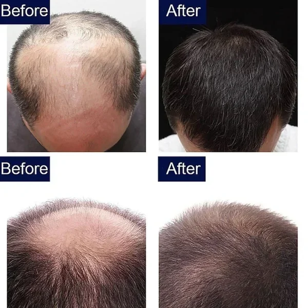 7 Day Rapid Growth Liquid Anti Hair Loss Ginger Growth Conditioning  Treatment Nourish Hair Growth Oil Scalp Care Serum Products - Image 3